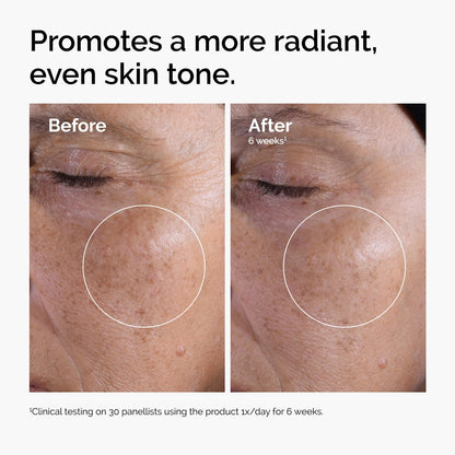 The Ordinary 디 오디너리 글라이콜릭애씨드 7% 엑스폴리에이팅 토너 — 각질 케어·톤업 데일리 토너