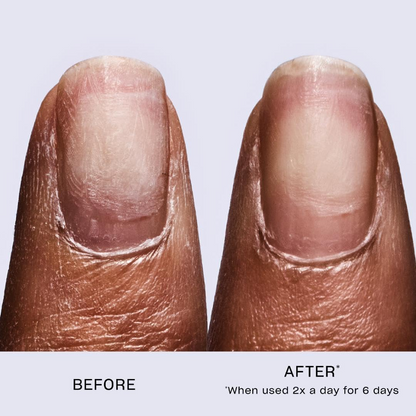 OPI Repair Mode Bond Building Nail Serum — Treatment for Damaged Nails (9 mL, NT200)