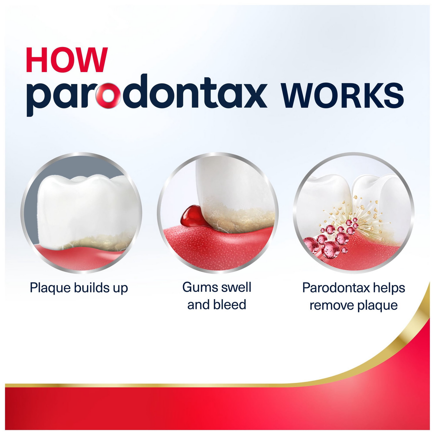 parodontax 파로돈탁스 액티브 검 리페어 브레스 프레시너 치약 5팩 잇몸병·잇몸 출혈 케어 불화제일주석 (5 × 3.4oz)